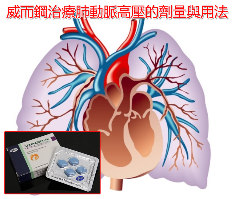 威而鋼治療肺動脈高壓的劑量與用法