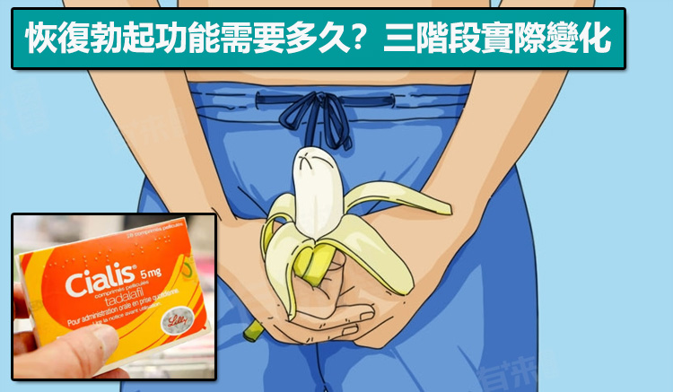 恢復勃起功能需要多久？三階段實際變化