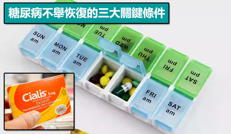 糖尿病不舉恢復的三大關鍵條件