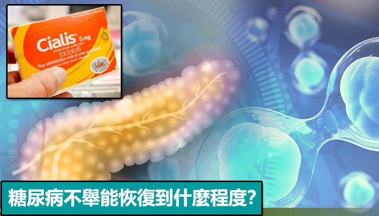糖尿病不舉能恢復到什麼程度？